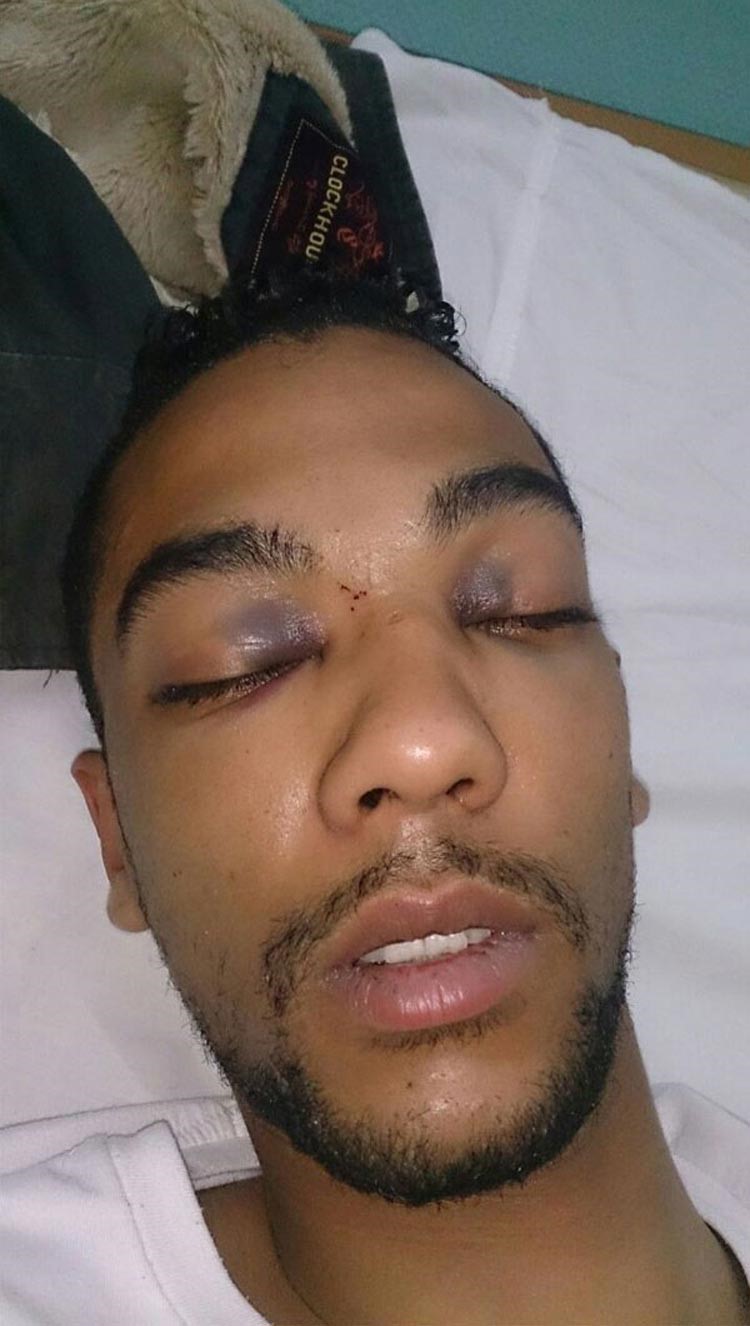 معجب يطالب محمد رمضان بـ2 مليون جنيه بعد اعتدائه عليه بالضرب.. والفنان يكشف التفاصيل.. صور