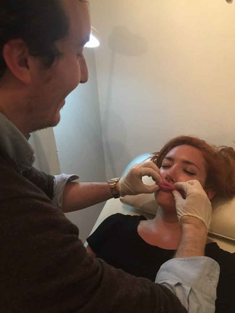 بالصور.. فتاة تخضع لعملية مدتها 6 ساعات كي تحصل على شفاه أنجلينا جولي لليلة واحدة