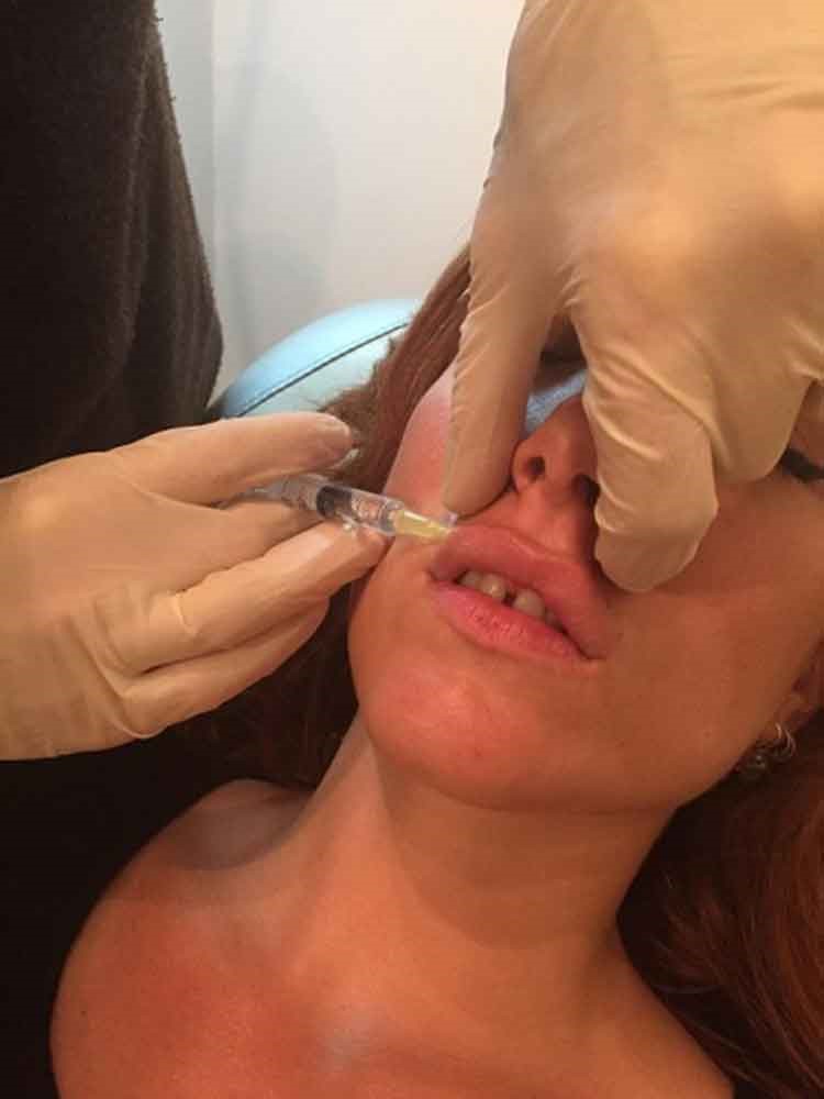 بالصور.. فتاة تخضع لعملية مدتها 6 ساعات كي تحصل على شفاه أنجلينا جولي لليلة واحدة