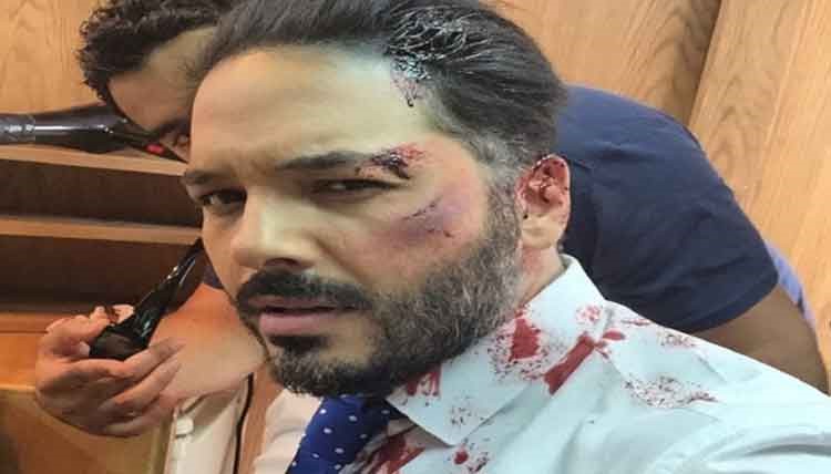 بالصور.. رامى عياش يتعرض لضرب مبرح يسيل الدماء من وجهه بسبب فتاة في الشارع ويؤكد: جت سليمة!