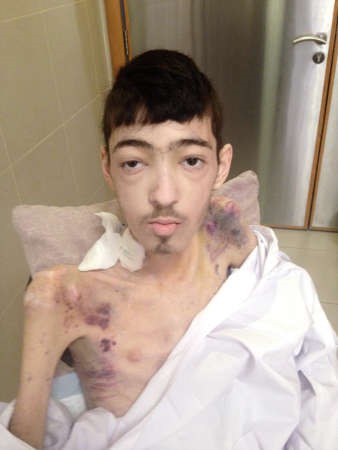منير يعاني بصمت