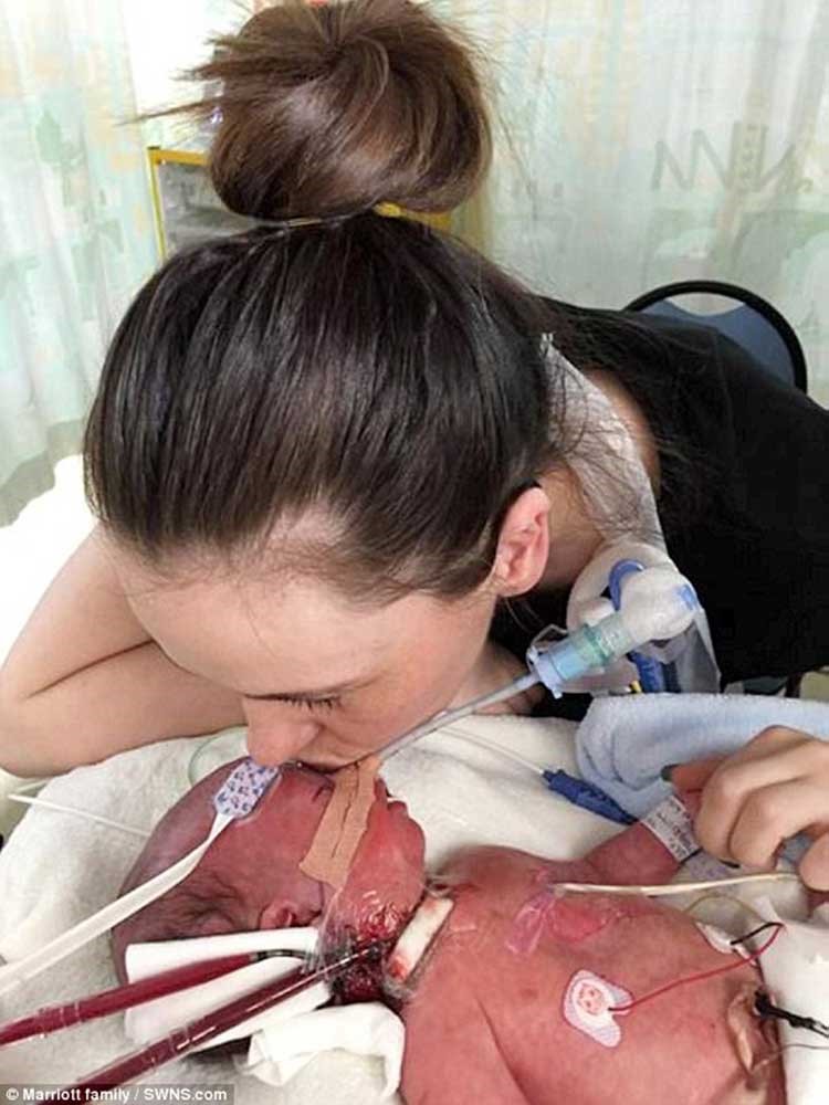 بالصور.. قبلة أم لطفلها قبل وفاته بدقائق 