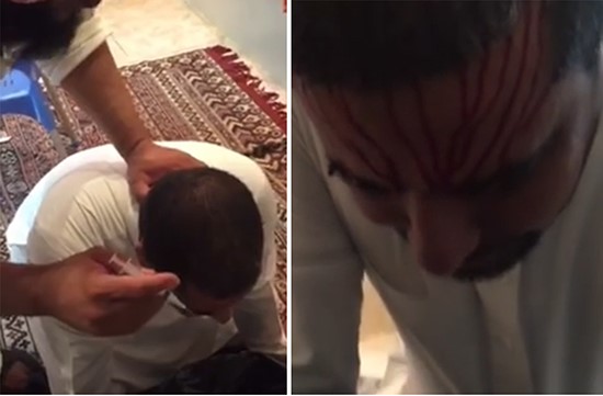 بالفيديو.. راقٍ سعودي يغرز حقنة طبية عشرات المرات برأس مريض بعد البصق عليه !