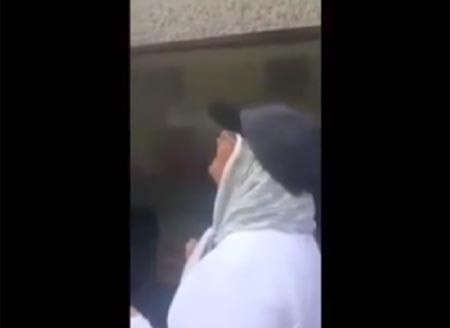 فيديو مؤثر.. إيرانية ضحية "الأسيد" تستعيد بصرها