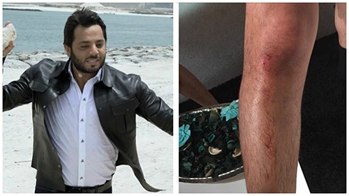 نيشان قام بمطاردة رامز جلال في مهبط الطائرات بعد اكتشافه للمقلب وقام برمي الصخور في اتجاه رامز جلال ووجه اليه ركلات قوية علق عليها رامز جلال قائلانيشان لما يضرب في المليانرباط صليبي نتيجة تكلنج من نيشان