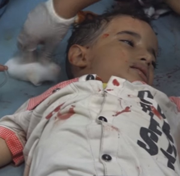 فيديو لطفل يمني قتل بشظية حوثية يقول "لا تقبروناش" يحقق مشاهدات قياسية