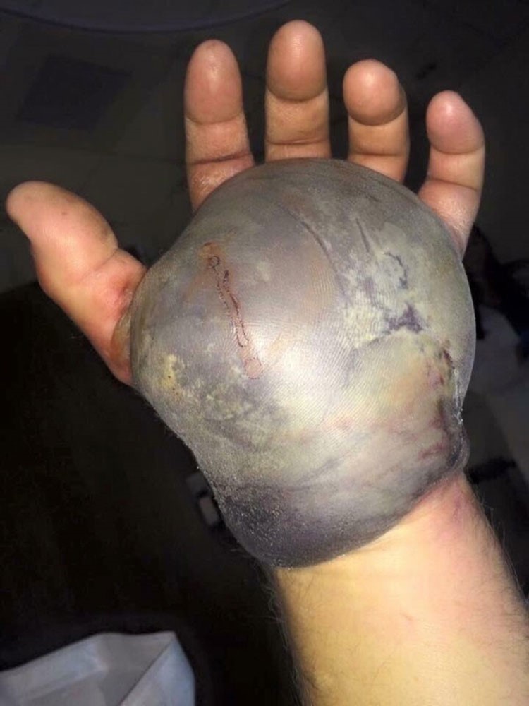 بالفيديو.. لحظة هجوم مباغت من افعى بالصحراء على سعودي.. شاهد ماذا حل به وكيف آذته؟ 