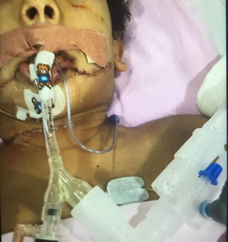 صور مؤلمة.. خادمة في السعودية تتسلل إلى غرفة طفل كفيلها أثناء نومه وتحاول قطع رأسه.. ومعجزة تنقذه