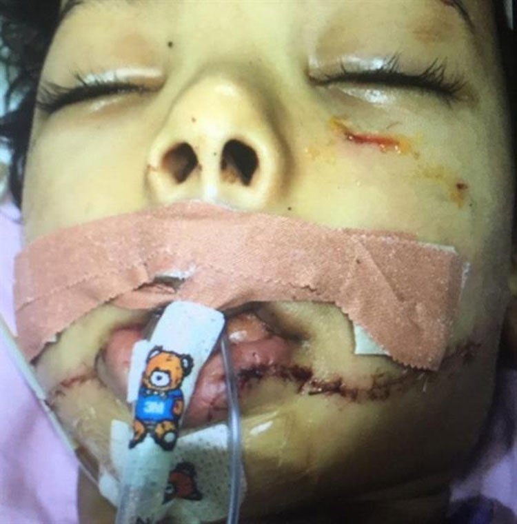 صور مؤلمة.. خادمة في السعودية تتسلل إلى غرفة طفل كفيلها أثناء نومه وتحاول قطع رأسه.. ومعجزة تنقذه