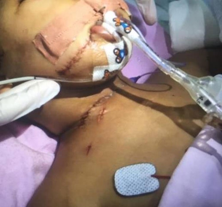 صور مؤلمة.. خادمة في السعودية تتسلل إلى غرفة طفل كفيلها أثناء نومه وتحاول قطع رأسه.. ومعجزة تنقذه