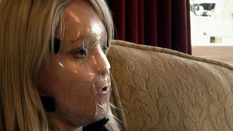 صورة لكاتي بعد 30 عملية تجميل