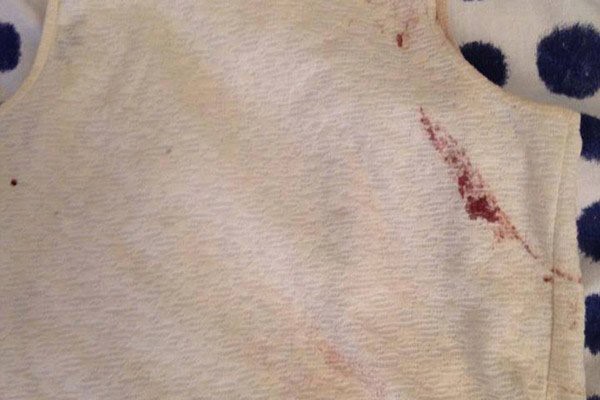 ناجية من باريس: رميت بنفسي بين الجثث وتظاهرت بالموت 