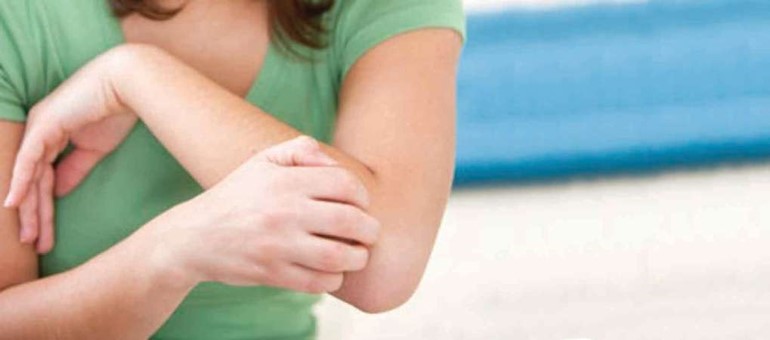 الصدفية اشهر الامراض الجلدية في الخليج
