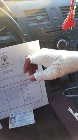 يد التلميذ بعد تضميدها