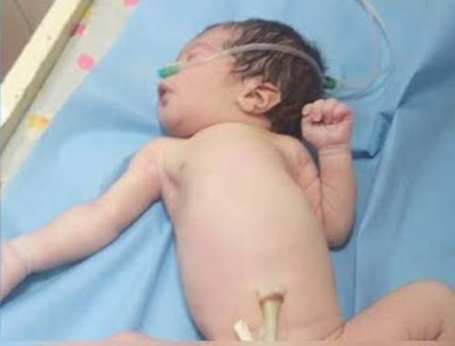 فيديو مروع من مصر.. سيدة تلقي طفلها الرضيع عقب ولادته من الدور الثالث