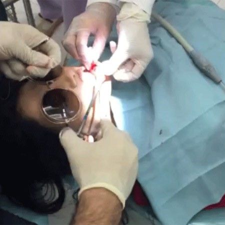 بالصور.. شيلاء سبت تجري عملية جراحية وهي ترتدي نظارتها الشمسية