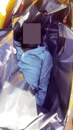 جثة الوافد قبل احالتها للطب الشرعي ﻿