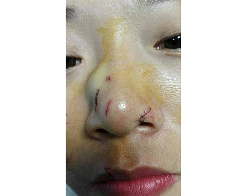 بالفيديو والصور.. شاهد ماذا فعل ثعبان مع سائحة حاولت تقبيله