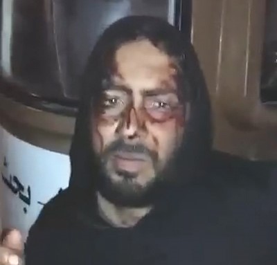 بالفيديو.. عملية قرصنة بحرية فاشلة تخلف 3 مصابين مصريين وضبط إيراني