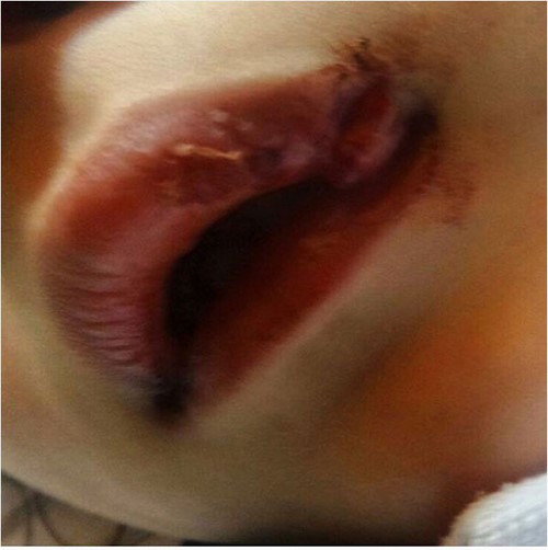 ماجد المصري ينشر صورة ابنته من غرفة العمليات ويطلب الدعاء