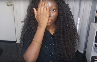 بالصور.. أصبحت فنانة ماكياج بعد سخرية الجميع من حروقها