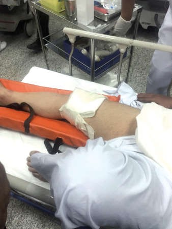 المواطن المصاب خلال تلقيه العلاج في مستشفى العدان﻿