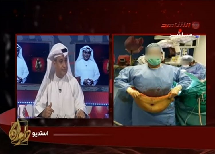 بالفيديو.. تلفزيون الشاهد يفجر فضيحة طبيب تجميل عربي في الكويت يعرض صور ضحاياه العراة على مواقع التواصل !!