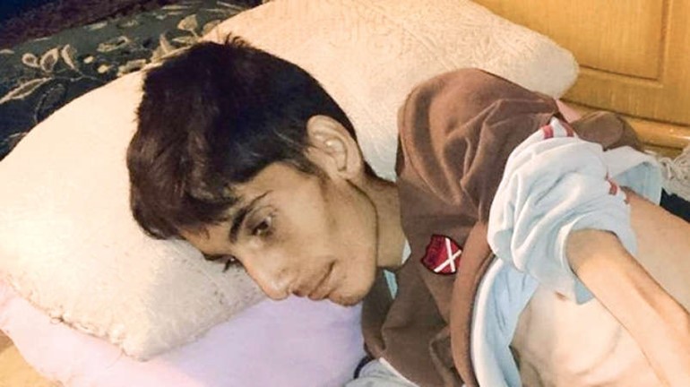 احد ضحايا الجوع والمرض في مضايا 