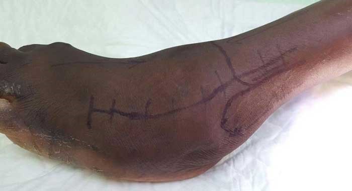  بالصور.. أسرة سعودية تحقق حلم عاملة منزلية تعاني من شلل منذ 20 عاماً