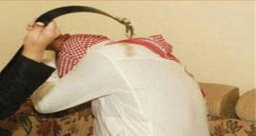 سعودية طقت زوجها طق اليهد وعضته وجلدته بالعقال.. وهو يكتفي برفع دعوى 