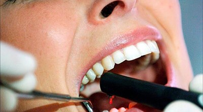 متى ينبغي خلع ضرس العقل؟