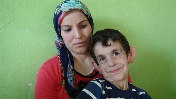 بالصور.. طفل سوري لم يبلغ الثامنة يبدو طاعناً في السن