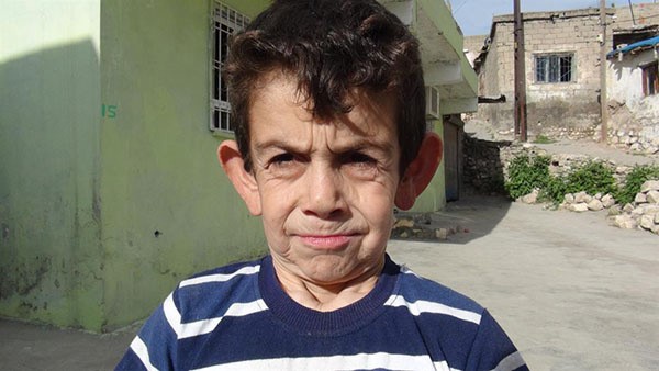 بالصور.. طفل سوري لم يبلغ الثامنة يبدو طاعناً في السن