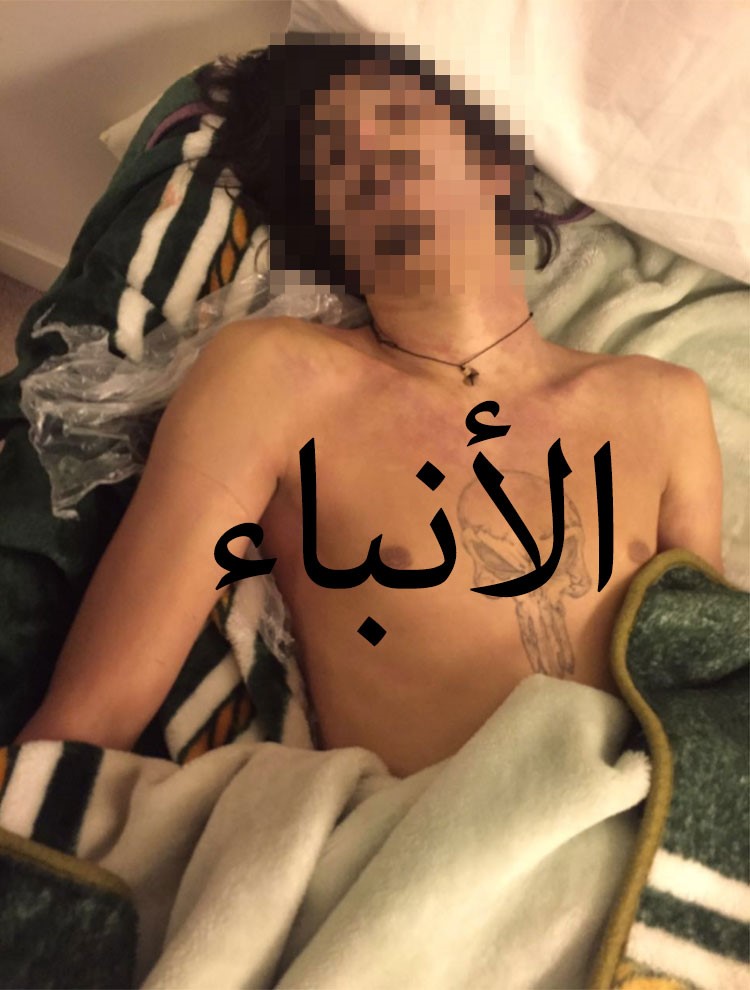 انتحار وافد من الجنسية السورية بكيس بلاستيكي في منطقة صباح السالم 