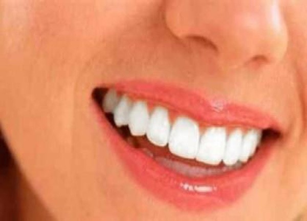 وصفات منزلية آمنة لأسنان ناصعة البياض 