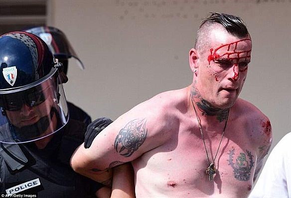 اثار الدماء تبدو على احد المشجعين المشاركين في اعمال الشغب التي وقعت بين مشجعي المنتخبين الروسي والانكليزي