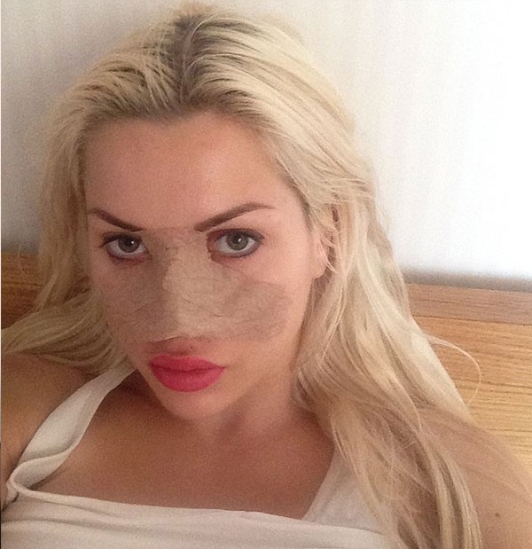 بالصور.. فتاة تخضع لـ18 عملية تجميل لتصبح شبيهة بشخصية كرتونية