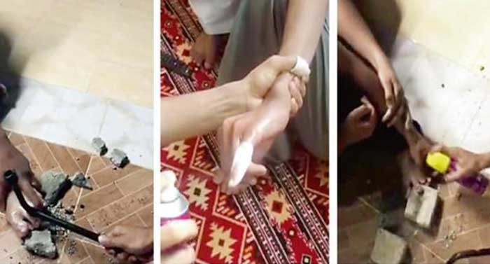 بالفيديو.. يكسرون عظامهم بـ"المطرقة".. ويخدرون أجسادهم بـ"بخاخ الحشرات"..من أجل اجازة !