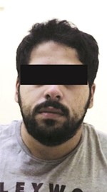 المتهم البدون ﻿
