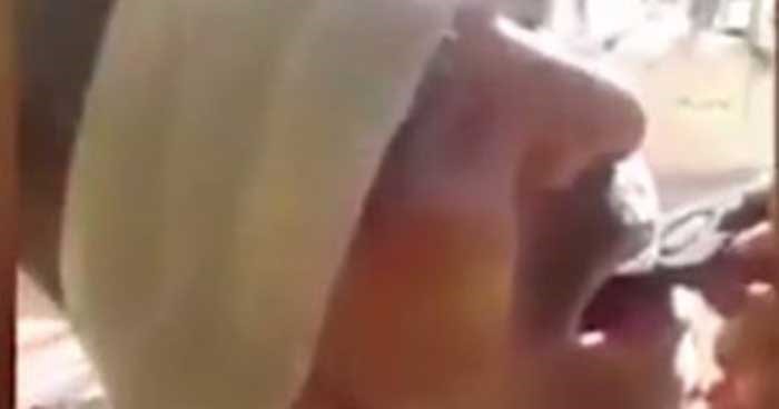 بالفيديو..مصرى يخلع ضرسه بـ"كماشة صدئه "..وصحف بريطانيا تسخر منه DIY !!