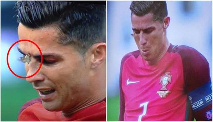 بالفيديو.. البرتغال تتوج بكأس أمم اوروبا للمرة الاولى في تاريخها على حساب فرنسا