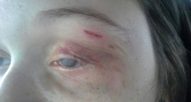 بالصور.. فتاة تتعرض للضرب المبرح بعدما تجاوزت نقطة تفتيش في مطار أميركي !