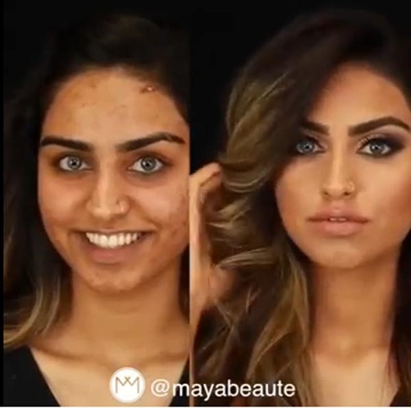 بالفيديو - تعلموا إخفاء بثور الوجه نهائياً بسهولة.. شاهدوا النتيجة بأنفسكم!
