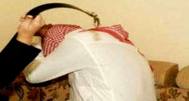 المنيع: ضرب الزوجة لزوجها حرام شرعًا حتى ولو في حالة دفاع عن النفس