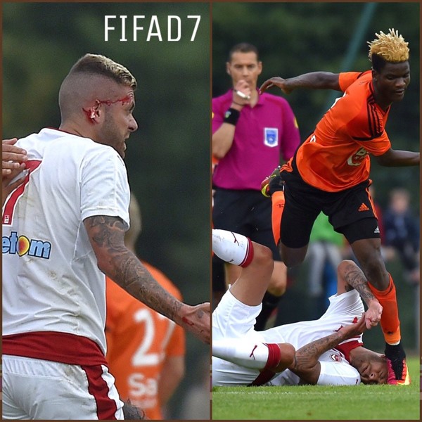 بالصور.. قطع أذن مينيز لاعب بوردو اثناء تعرضة للعرقلة!