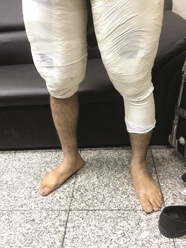 هكذا الصقها على فخذيه