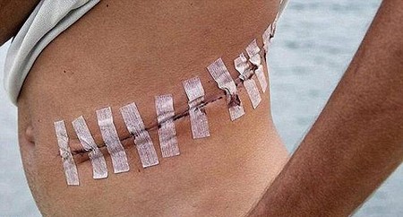 أبشع طرق داعش لبيع أعضاء بشرية بمساعدة أطباء أجانب