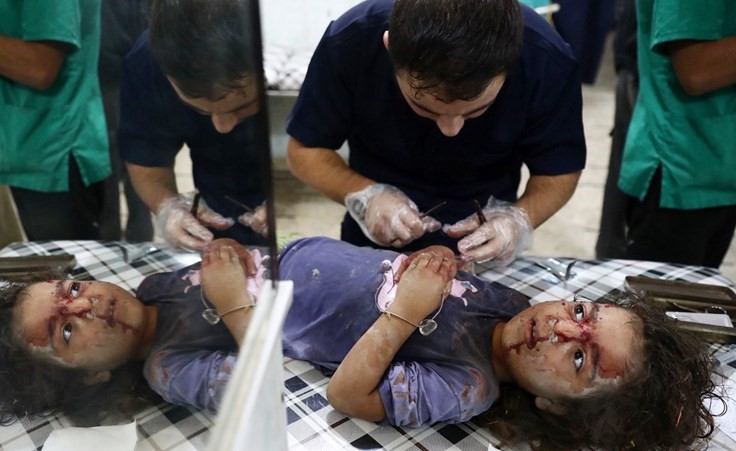 طفلة تتلقى العلاج في مستشفى ميداني بعد اصابتها في غارة للنظام على دوما بريف دمشق	 افپ﻿