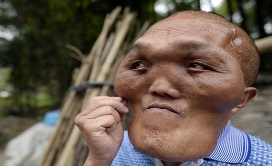 شاهد.. كيف أصبح هذا الرجل أشبه بالمخلوقات الفضائية