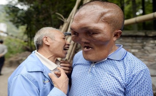 شاهد.. كيف أصبح هذا الرجل أشبه بالمخلوقات الفضائية
